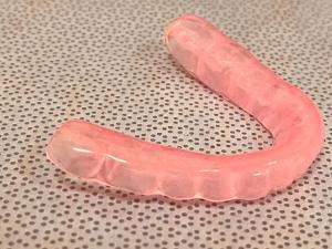 Anterior repositioning appliance