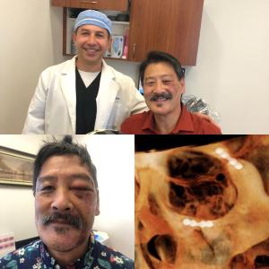 facial trauma patient