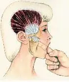 Illustration of Temporal tendonitis testing technique