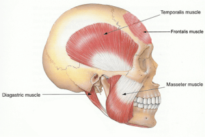 Illustration of a botox injection site for TMJ treatment