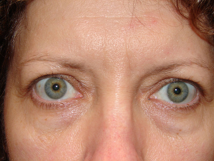Eyes and Brows