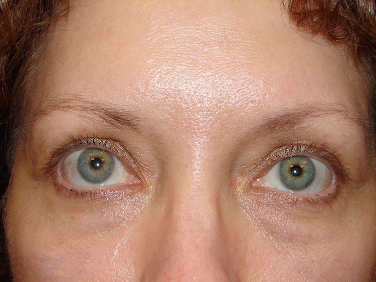 Eyes and Brows
