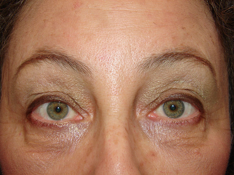 Eyes and Brows